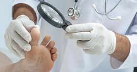 The doctor examines the legs affected by the sponge
